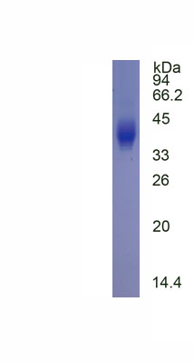 Eukaryotic Galanin (GAL)