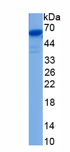 Eukaryotic Interleukin 31 (IL31)