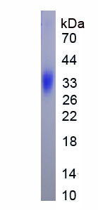 Eukaryotic Androgen Receptor (AR)