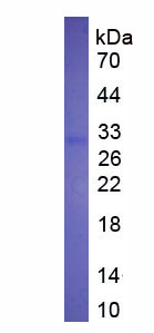 Eukaryotic Tumor Necrosis Factor Receptor Superfamily, Member 9 (TNFRSF9)