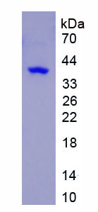 Eukaryotic Trefoil Factor 3 (TFF3)