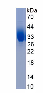 Eukaryotic Transglutaminase 3, Epidermal (TGM3)