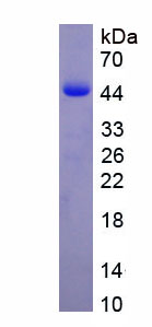 Eukaryotic S100 Calcium Binding Protein A9 (S100A9)