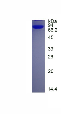Eukaryotic Vitamin D Binding Protein (DBP)
