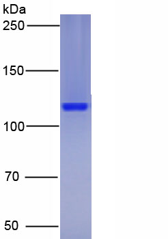 Eukaryotic Vascular Endothelial Growth Factor Receptor 1 (VEGFR1)