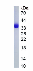 Eukaryotic Growth Differentiation Factor 5 (GDF5)