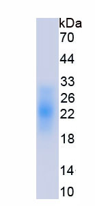 Eukaryotic Activin A Receptor Type I C (ACVR1C)