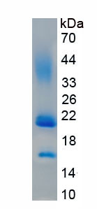 Eukaryotic Endothelial Cell Specific Molecule 1 (ESM1)