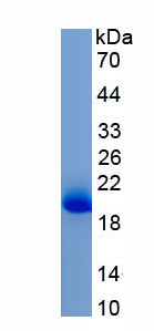 Eukaryotic Gastrokine 1 (GKN1)