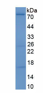 Eukaryotic Insulin Like Growth Factor Binding Protein 5 (IGFBP5)