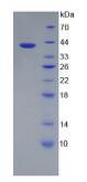 Eukaryotic Platelet Activating Factor Receptor (PAFR)