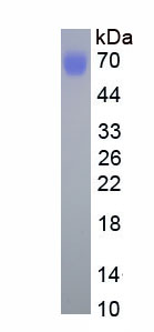 Eukaryotic Kallistatin (KAL)