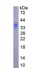 Eukaryotic Prestin (PRES)