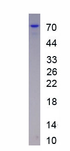 Eukaryotic Interleukin 18 Binding Protein (IL18BP)