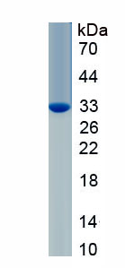 Eukaryotic Coxsackie Virus And Adenovirus Receptor (CXADR)