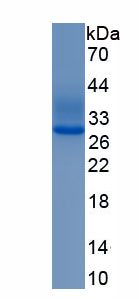 Eukaryotic HIV1 Tat Specific Factor 1 (HTATSF1)