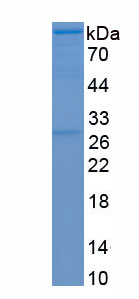 Eukaryotic Major capsid protein L1, HPV58 (HPV58 L1)