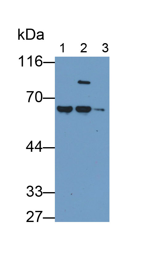 Monoclonal Antibody to Alpha-1-Antitrypsin (a1AT)