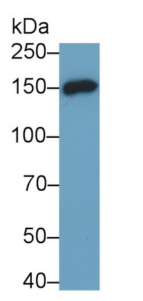 Monoclonal Antibody to Cluster Of Differentiation (C<b>D163</b>)