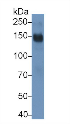 Monoclonal Antibody to Cluster Of Differentiation (C<b>D163</b>)