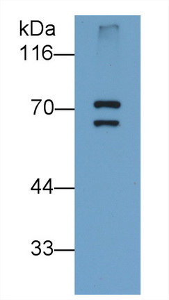 Monoclonal Antibody to Peptidyl Arginine Deiminase Type VI (PADI6)