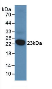 Monoclonal Antibody to Dual Specificity Phosphatase 3 (DUSP3)