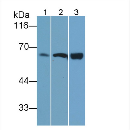 Monoclonal Antibody to Plastin 3 (PLS3)