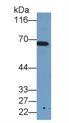 Monoclonal Antibody to Plastin 3 (PLS3)