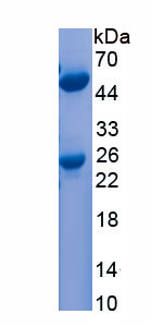 Native Immunoglobulin M (IgM)