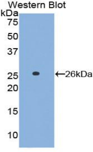 Polyclonal Antibody to Linker For Activation Of T-Cell (LAT)