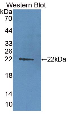 Polyclonal Antibody to Damage Specific DNA Binding Protein 2 (DDB2)
