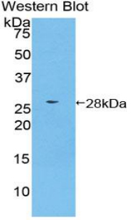 Polyclonal Antibody to Casein Kinase 1 Alpha 1 (CSNK1a1)