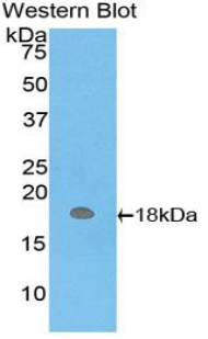 Polyclonal Antibody to Hemoglobin Mu (HBm)