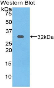 Polyclonal Antibody to Heat Shock 70kDa Protein 4 (HSPA4)