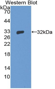 Polyclonal Antibody to General Transcription Factor IIH Subunit 1 (GTF2H1)
