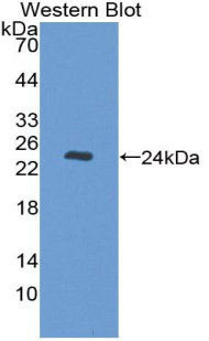 Polyclonal Antibody to Nucleoporin 35kDa (NUP35)