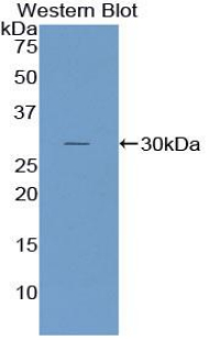 Polyclonal Antibody to Nucleoporin 107kDa (NUP107)