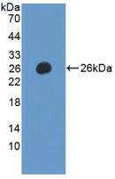 Polyclonal Antibody to Leukocyte Immunoglobulin Like Receptor Subfamily B, Member 2 (LILRB2)