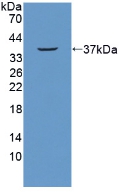 Polyclonal Antibody to Nucleoporin 214kDa (NUP214)