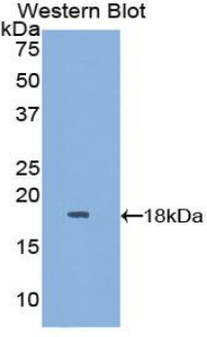 Polyclonal Antibody to Glia Maturation Factor Gamma (GMFg)