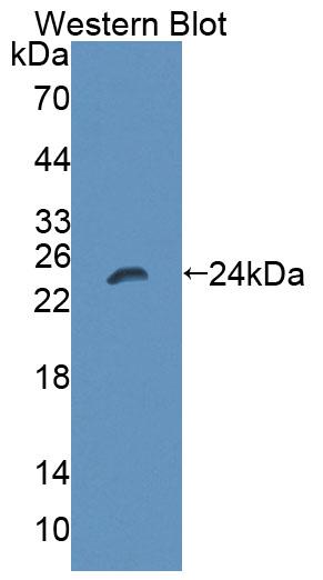 Polyclonal Antibody to ATP Dependent DNA ligase I (LIG1)