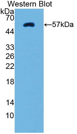 Polyclonal Antibody to Protein Tyrosine Kinase 2 Beta (PYK2)