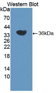 Polyclonal Antibody to 15-Lipoxygenase-2 (15-LO-2)