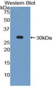 Polyclonal Antibody to Protocadherin 1 (PCDH1)