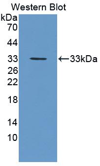 Polyclonal Antibody to Protocadherin 1 (PCDH1)