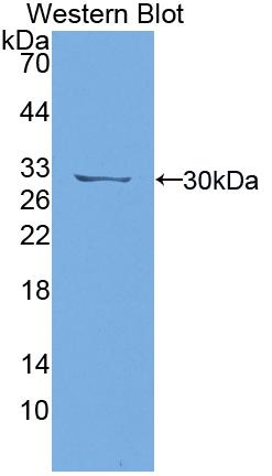 Polyclonal Antibody to Density Enhanced Phosphatase 1 (DEP1)