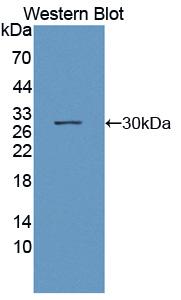 Polyclonal Antibody to Octamer Binding Transcription Factor 2 (OCT2)