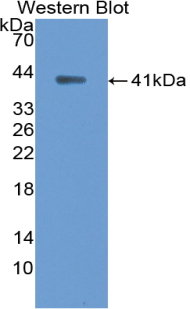 Polyclonal Antibody to Ankyrin 1, Erythrocytic (ANK1)
