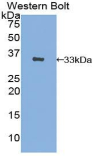 Polyclonal Antibody to Band 3 (BND3)