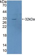 Polyclonal Antibody to Serum/Glucocorticoid Regulated Kinase 1 (SGK1)
